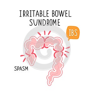 Vector illustration of irritable bowel syndrome