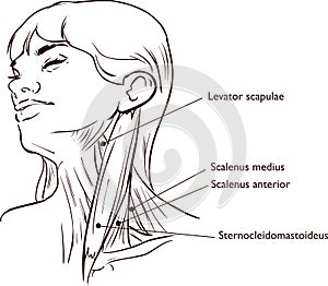 Vector illustration of Neck muscles anatomy