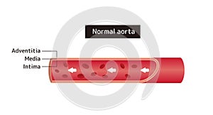 Vector illustration of normal aorta