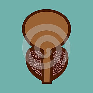 Vector illustration of prostatitis. sexual infections, prostate.