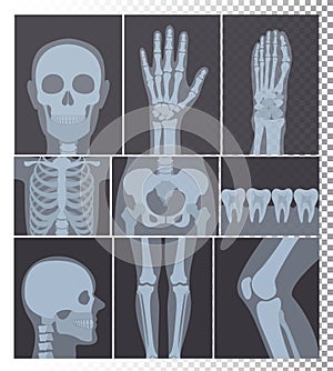 Vector illustration of realistic X-rays shots collection. X-ray pictures of head, bones, teeth set, body parts X ray set