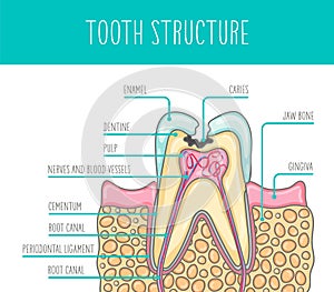 Vector illustration of a sick human tooth human tooth structure.