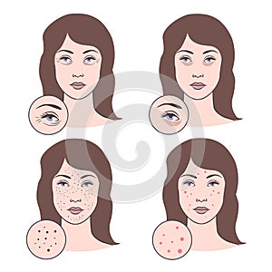 Vector illustration of skin problems