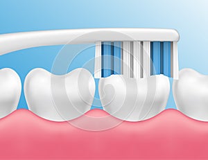 Vector illustration of teeth cleaning with a brush - dental hygiene concept