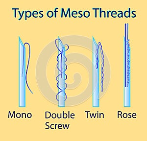 Vector illustration with types of meso threads