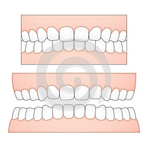 Vector illustration of white teeth and gums from a frontal perspective for medical and dental depictions