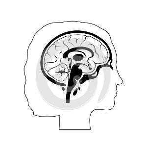 Vector illustration of woman brain anatomy