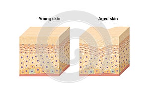Vector illustration of young and aged skin