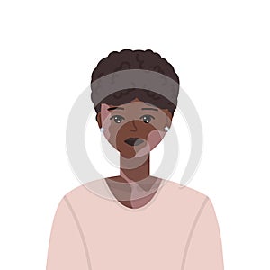 Vector illustration of young and beautiful black woman with vitiligo skin disorder. Model girl has depigmentation