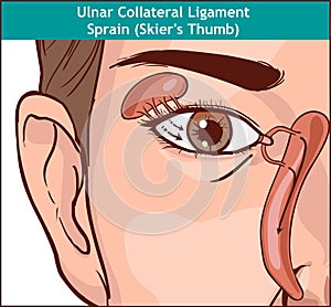 Vector illutration, anatomy of the Lacrimal apparatus photo