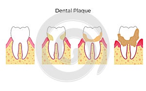 Vector isolated illustration of tooth photo