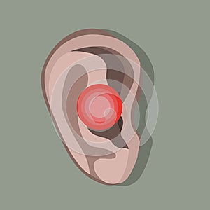 Vector isolated illustration of ear diseases.