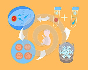 Vector isolated illustration of egg and sperm freezing. Cryopreservation. Preparation for artificial insemination. Egg and sperm