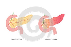 Vector isolated illustration of pancreas