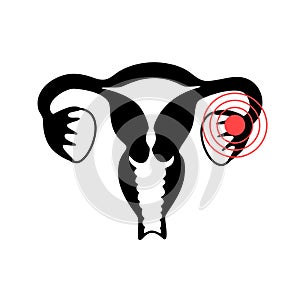 Vector isolated illustration of uterus with pain