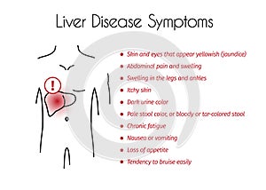 Vector Liver Disease Symptoms Infographic of Young Man