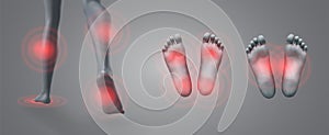 vector set of legs with red patches of pain on a gray background