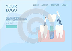 Vector website design in a flat style. Two implantologist doctors install a dental implant: put a crown on the abutment