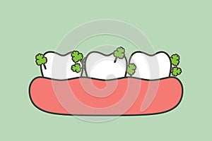 Vegetable stuck in teeth, cause of decay tooth and bad breath