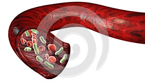 Vein and red blood cells attacked by a virus, circulation of bacteria within an artery