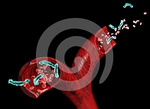 Vein and red blood cells attacked by a virus, circulation of bacteria within an artery. Escherichia coli. Section of a vein