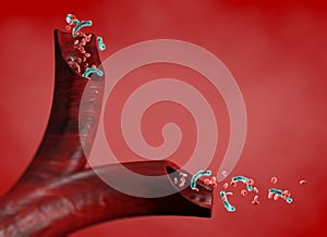 Vein and red blood cells attacked by a virus, circulation of bacteria within an artery. Escherichia coli. Section of a vein