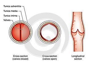 Vein valves photo