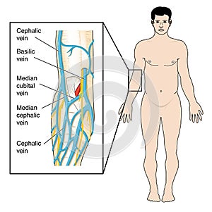 Veins of the antecubital fossa