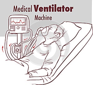 Ventilator Medical Machine Equipment fo Tracheostomy Patient Breathing in Operating Room Surgery Hospital Clinical ICU Intensive