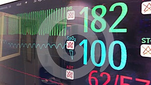 Ventricular fibrillation