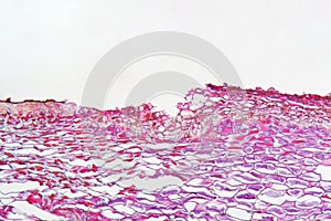 Venturia pyrina under the microscope