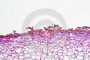 Venturia pyrina under the microscope