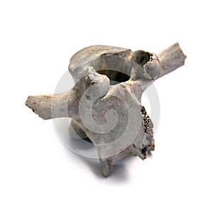 Vertebra