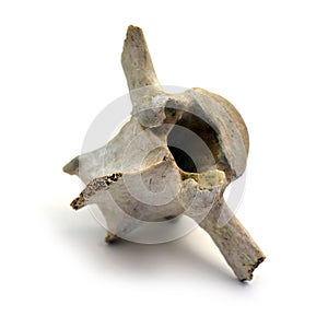 Vertebra