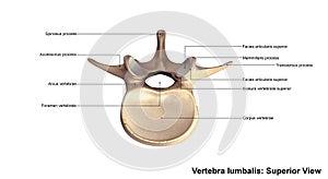 Vertebra lumbalis_Superior view