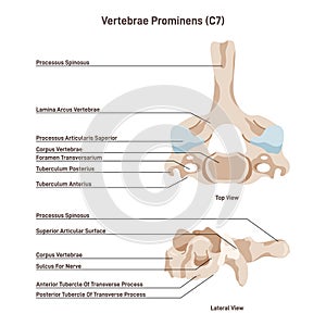 Vertebra prominens. Anatomy of the 7th cervical vertebra. C7.