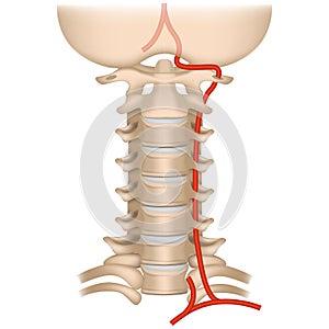 vertebral artery syndrome. Cervical spine.