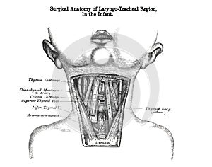 Vertical shot of a surgical anatomy of laryngo - tracheal region in the infant