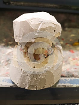 Vertical shot of an upper and lower teeth prosthesis mold