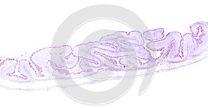 Gastric mucosa. PAS method