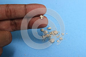 Very small kidney stone at man finger at blue background