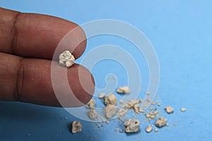 very small kidney stone at two finger at blue background