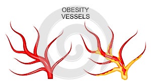 Vessels healthy and obese