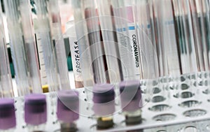 Vial pcr of SarsCov2 coronavirus