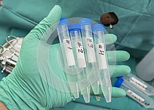 Vials with four samples of cerebrospinal fluid in patients with transverse myelitis after being injected with an experimental photo