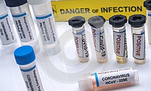 Vials of samples with positive results from patients infected with covid-19 coronavirus in a laboratory