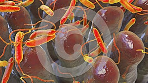 Vibrio cholerae bacteria infecting small intestine
