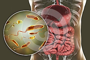 Vibrio cholerae bacteria in small intestine
