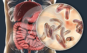 Vibrio cholerae bacteria in small intestine