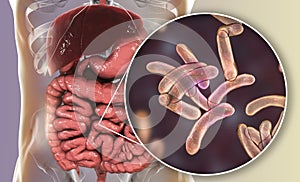 Vibrio cholerae bacteria in small intestine